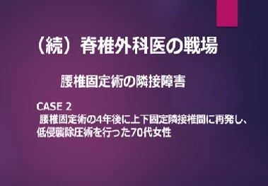 腰椎固定術の4年後に上下固定隣接椎間に再発した70代女性